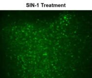 Ensayo de peroxinitrito intracelular fluorimétrico Cell Meter™