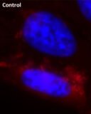 Cell Navigator® Fluorimetric Lipid Droplet Assay Kit *Red Fluorescence*