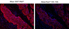 iFluor® 555™ PSA™ Imaging Kit with Goat Anti-Mouse IgG