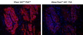 iFluor® 647 PSA™ Kit de imágenes, con IgG anti-ratón de cabra