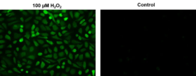 Ensayo de peróxido de hidrógeno intracelular fluorimétrico Cell Meter™