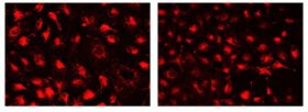 Tinción CytoFix™ Red Lysosomal